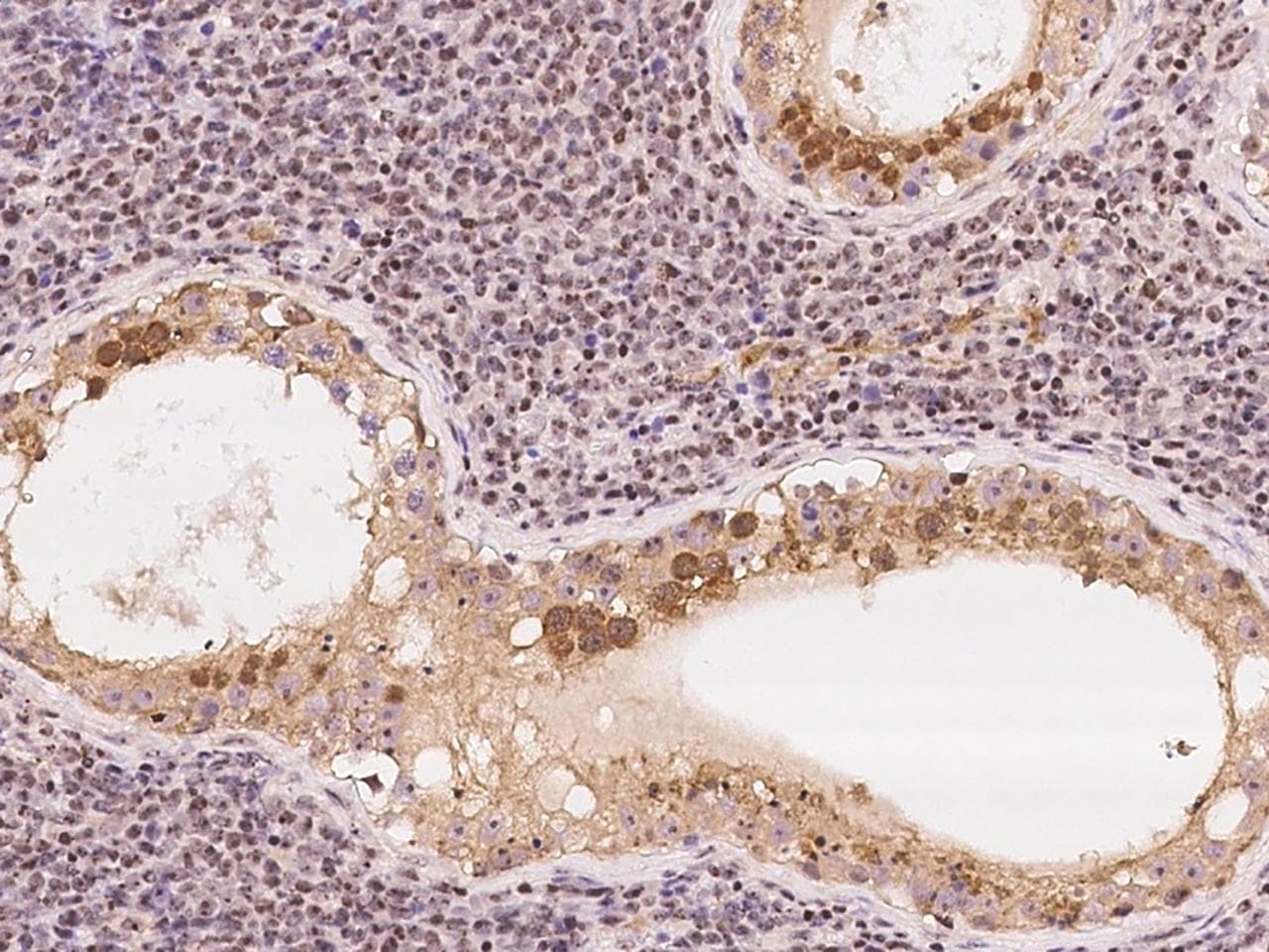 DNTTIP2 Antibody