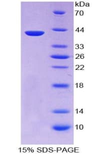 Human KRT3 / CK3 / Cytokeratin 3 Protein (Recombinant His-T7)