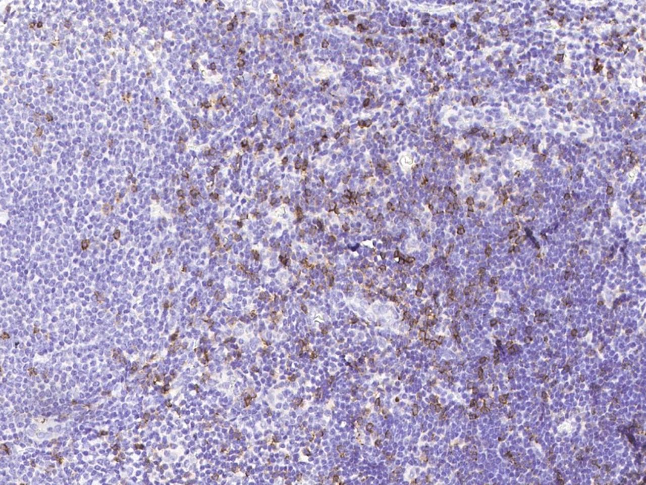 CD8A / CD8 Alpha Antibody (clone 38, Preservative Free)