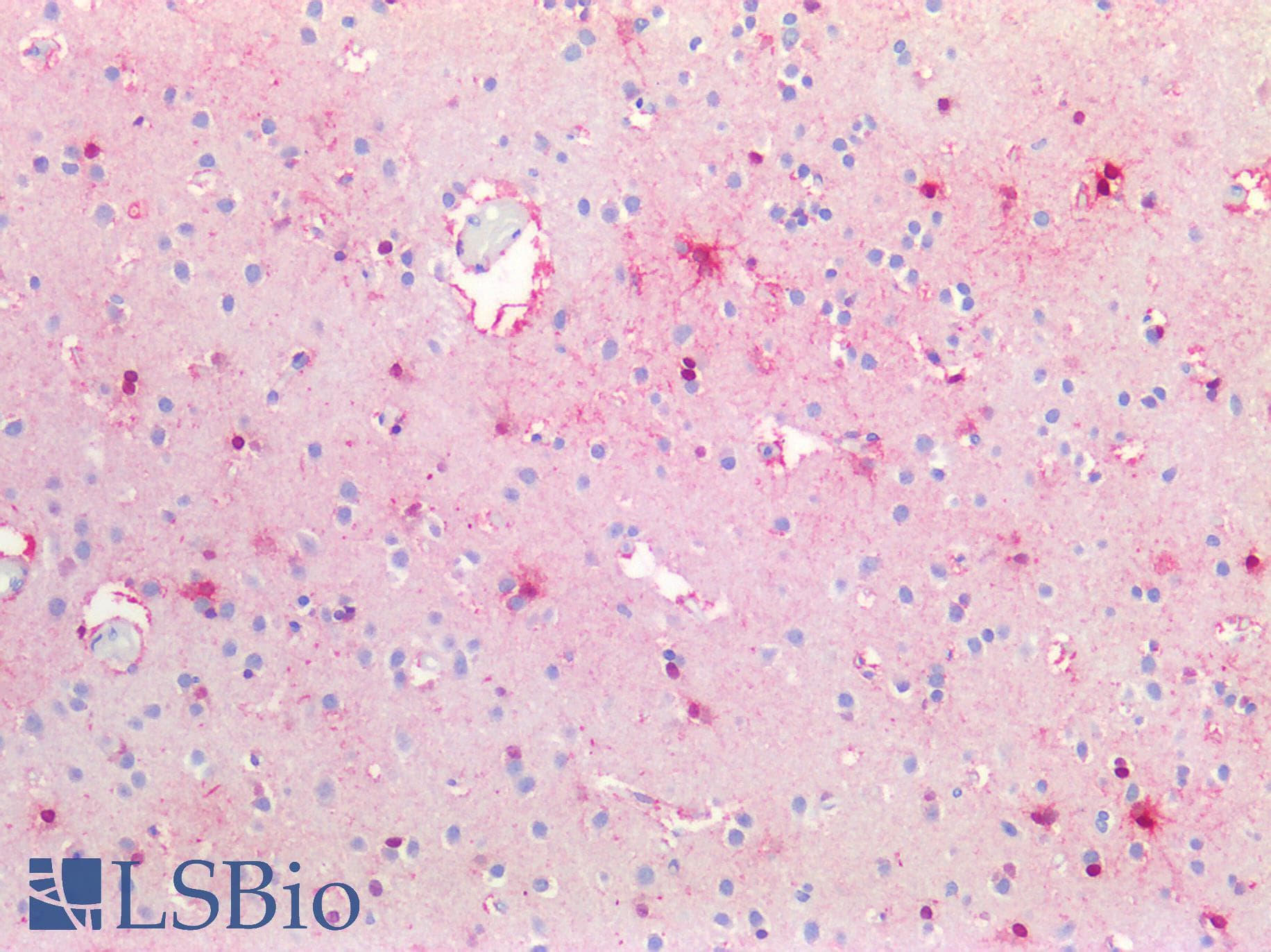 PathPlus™ Polyclonal Rabbit anti-Human BMP6 Antibody (IHC, WB)
