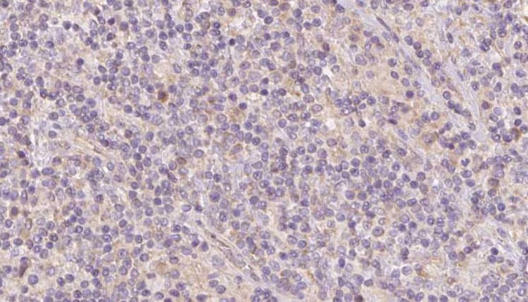 CKMT1 Antibody