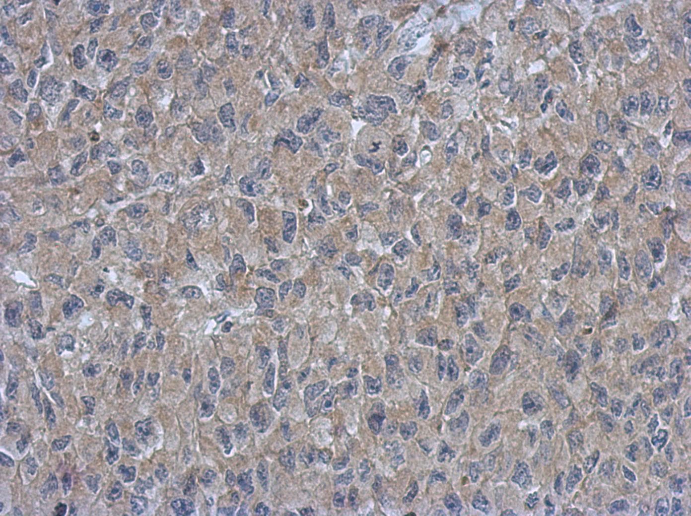Polyclonal Rabbit anti-Human ARMC1 Antibody (IHC, WB)