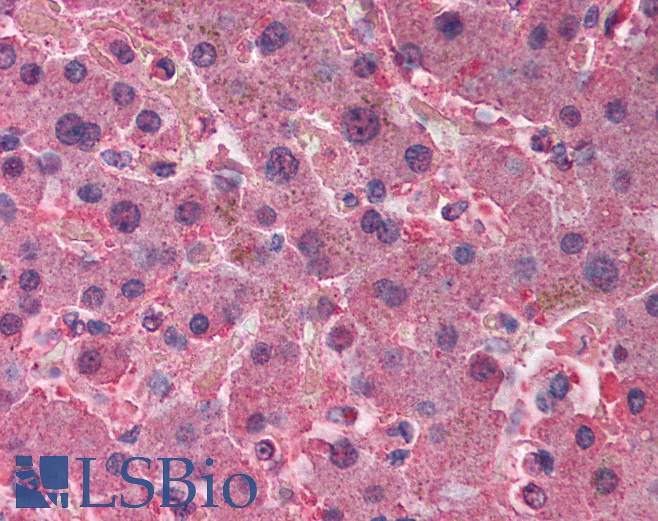 IHC-plus™ Polyclonal Goat anti-Human AHSG / Fetuin A Antibody (IHC, WB)