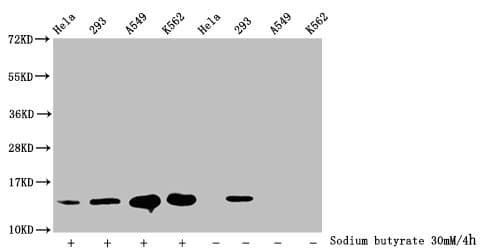 HIST1H2BN Antibody