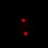 Polyclonal Rabbit anti-Human PRPF3 Antibody (IHC, IF, WB)