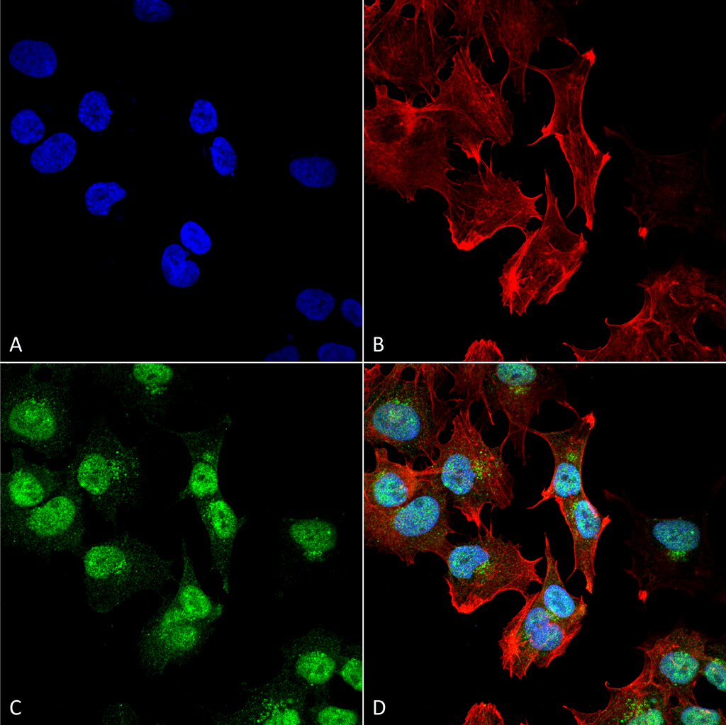 ADORA1 / Adenosine A1 Receptor Antibody (FITC)
