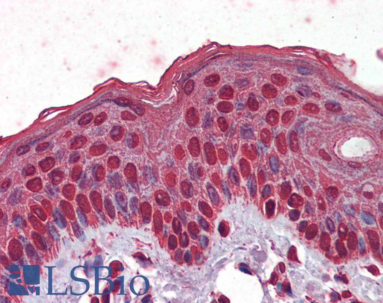IHC-plus™ EPHA2 / EPH Receptor A2 Antibody (clone 1B3C7)