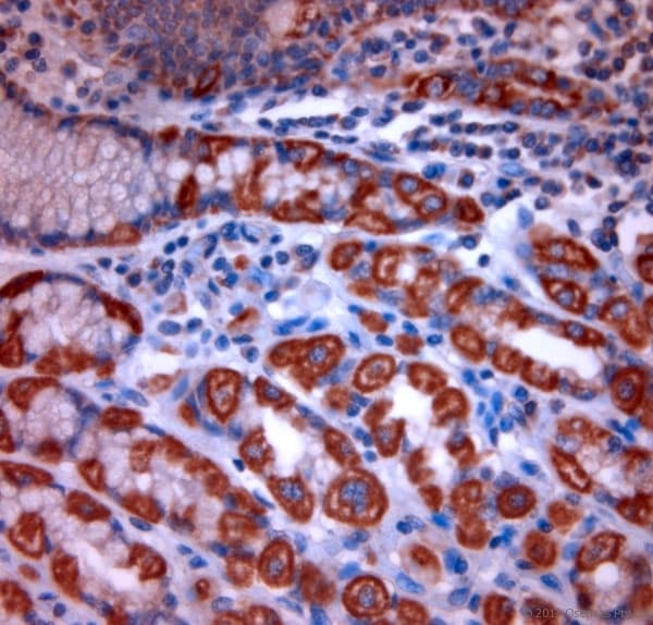 TPC2 / TPCN2 Antibody (aa700-752)