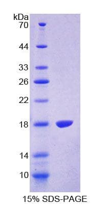 Human TRPV3 Protein (Recombinant His-T7)