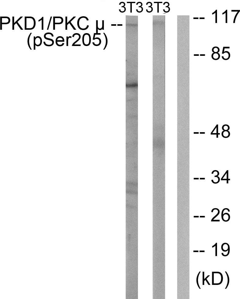 Polyclonal Rabbit anti-Human PRKD1 / PKC Mu Antibody (phospho-Ser205, IHC, WB)