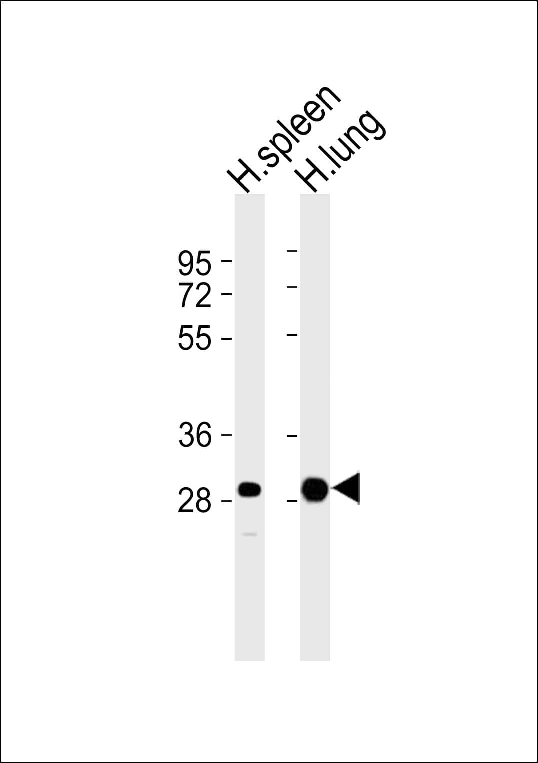 CASP1 / Caspase 1 Antibody