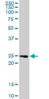 IHC-plus™ Monoclonal Mouse anti-Human TNFRSF18 / GITR Antibody (clone 2H4, IHC, WB)