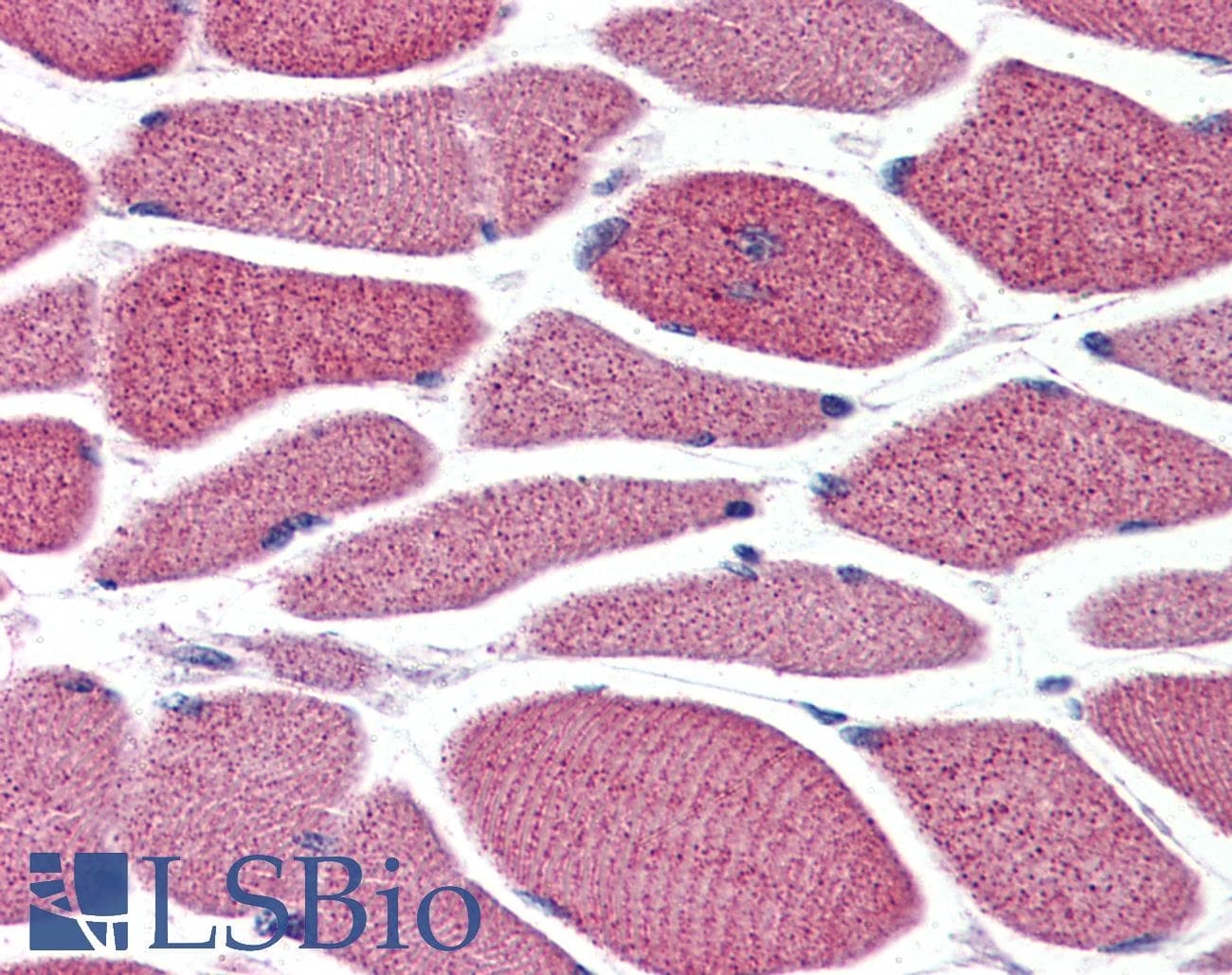 IHC-plus™ Polyclonal Rabbit anti-Human SPHK / SPHK1 Antibody (N-Terminus, IHC)