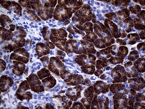 NDUFAF5 Antibody (clone OTI6A9)