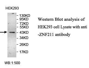 CD121b / IL1R2 Antibody (aa90-343)