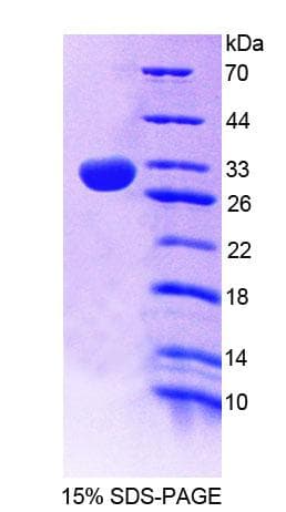 Mouse PLCE1 Protein (Recombinant His-T7, N-terminus)