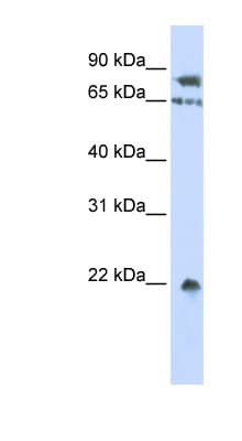 SENP1 Antibody (C-Terminus)