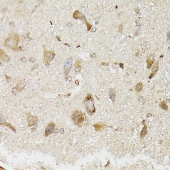 Polyclonal Rabbit anti-Human NDUFS7 Antibody (IHC, WB)