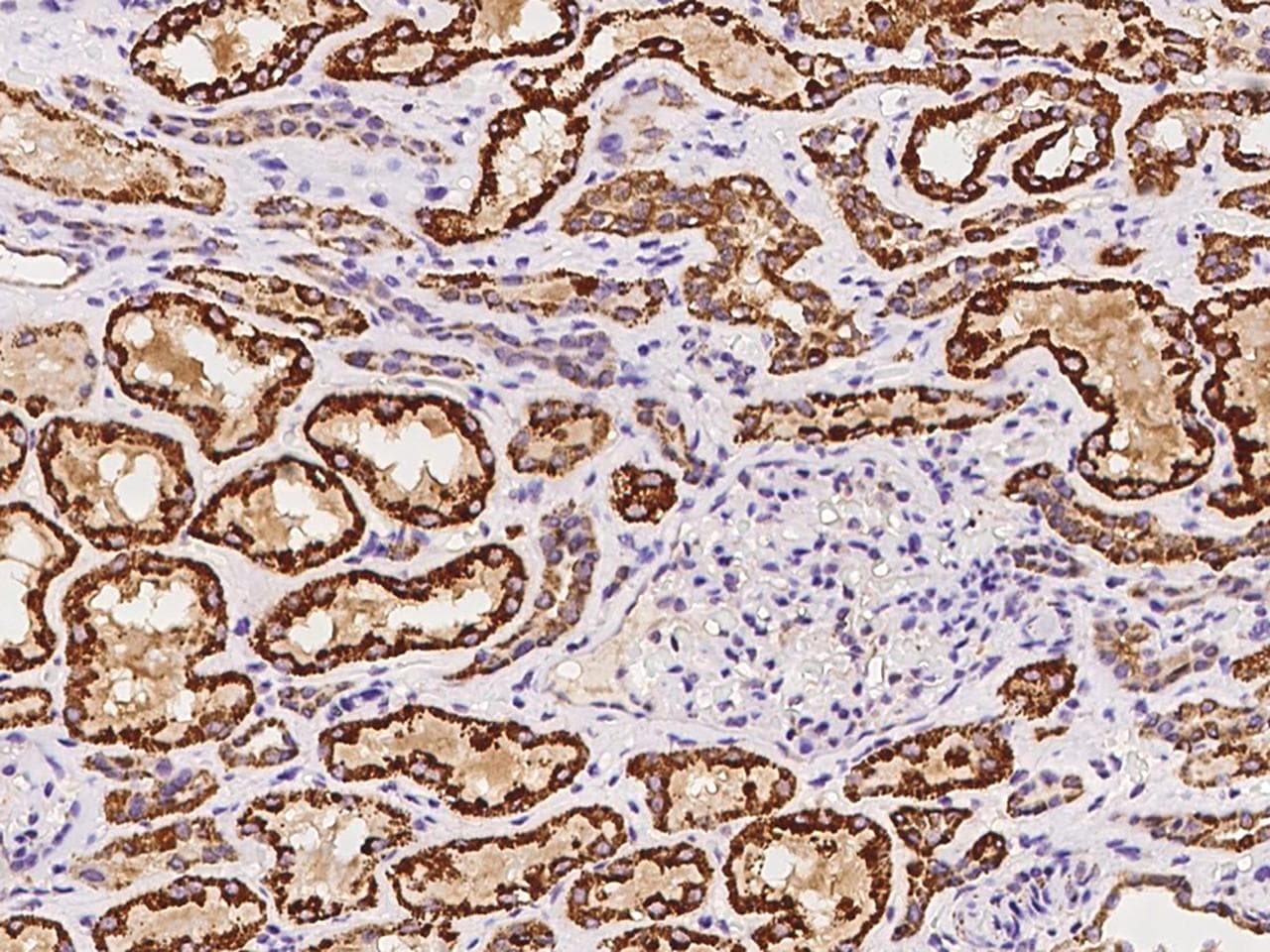 Polyclonal Rabbit anti-Human EIF3S5 / EIF3F Antibody (IHC, IF, WB)