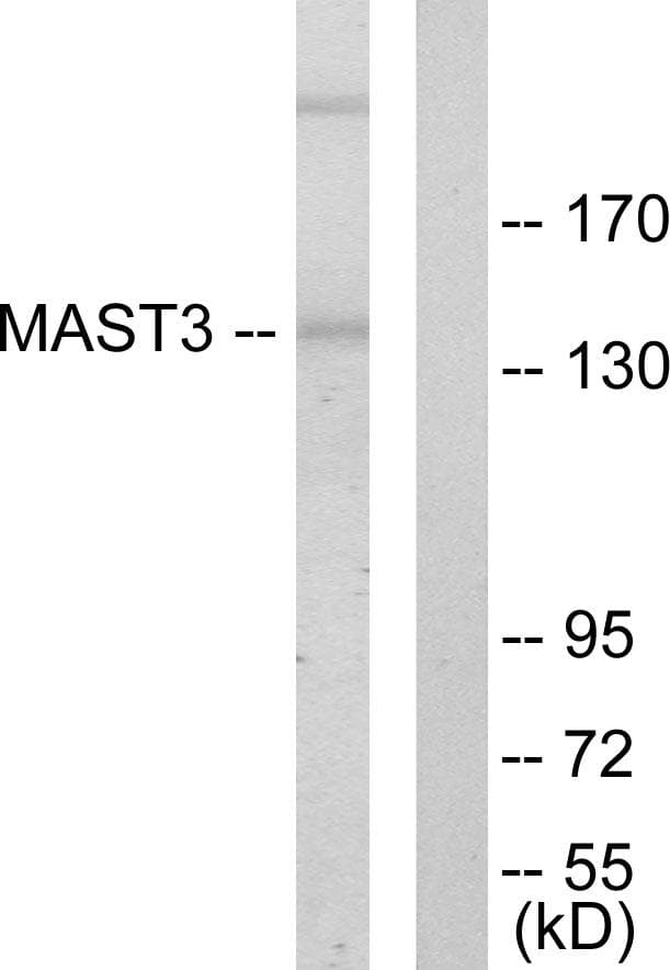 Polyclonal Rabbit anti-Human MAST3 Antibody (WB)