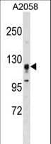 STK31 Antibody (aa32-62)