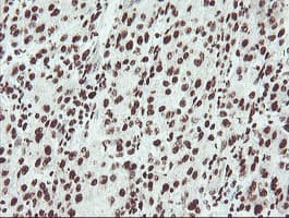 Monoclonal Mouse anti-Human NONO / P54NRB Antibody (clone OTI2E7, IHC, WB)