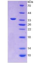 Human ANXA5 / Annexin V Protein (Recombinant His)