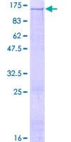 Human RECK Protein (Recombinant GST)
