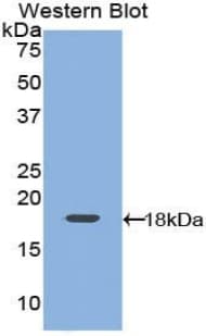 Leptin Antibody (aa15-141)
