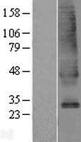SLC39A9 Protein (Over-Expression Lysate Myc-DDK (Flag))