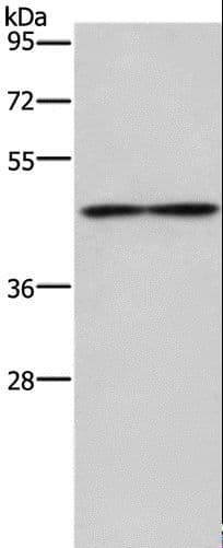 IL5RA / CD125 Antibody