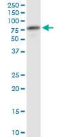 IHC-plus™ ATP6V1A1 / ATP6V1A Antibody (clone 4F5)