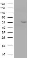Monoclonal Mouse anti-Human CYP1A2 Antibody (clone OTI2E9, WB)