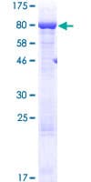 Human AARSD1 Protein (Recombinant GST)