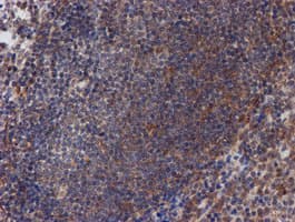 ATRIP Antibody (clone OTI5E7)