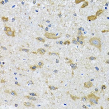 CCT4 / SRB Antibody