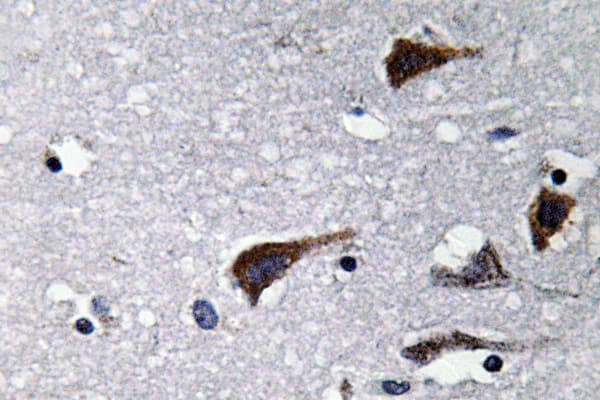 CTSB / Cathepsin B Antibody (aa168-217)
