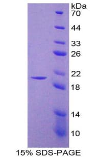 Rat NOS2 / iNOS Protein (Recombinant His)