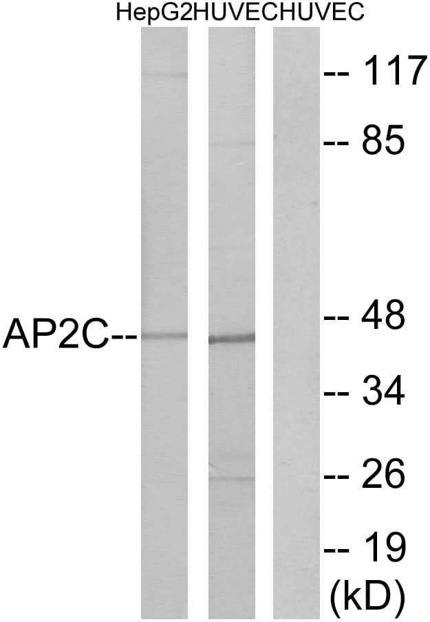 Polyclonal Rabbit anti-Human TFAP2C / AP2 Gamma Antibody (aa401-450, WB)