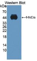 Polyclonal Rabbit anti-Human ADAMTS10 Antibody (aa239-602, WB)