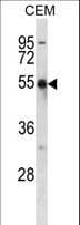 KCNA2 / Kv1.2 Antibody (aa451-479)