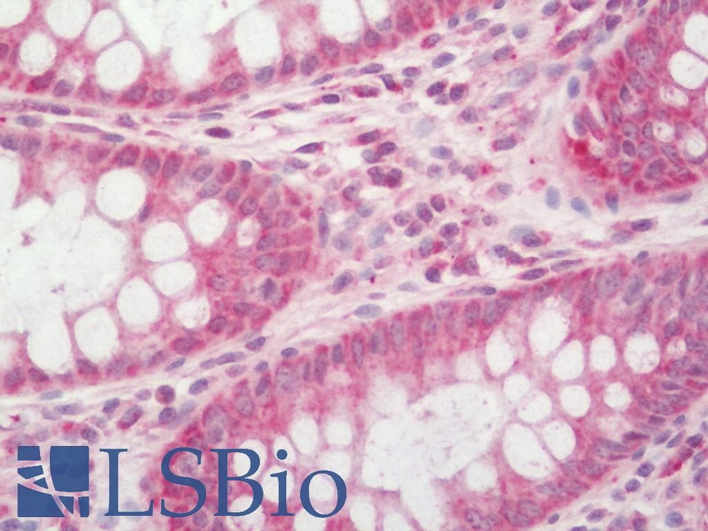 IHC-plus™ IDH3B Antibody