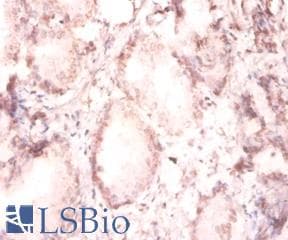 PathPlus™ FGF2 / Basic FGF Antibody (aa 143-288)