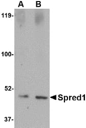 IHC-plus™ Polyclonal Rabbit anti-Human SPRED1 Antibody (IHC, IF, WB)