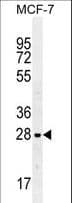 Polyclonal Rabbit anti-Human LGALS3 / Galectin 3 Antibody (aa163-191, WB)