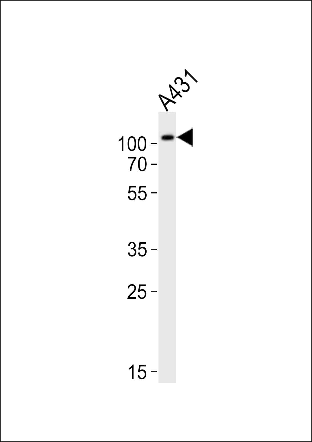 IARS2 Antibody (aa51-82)