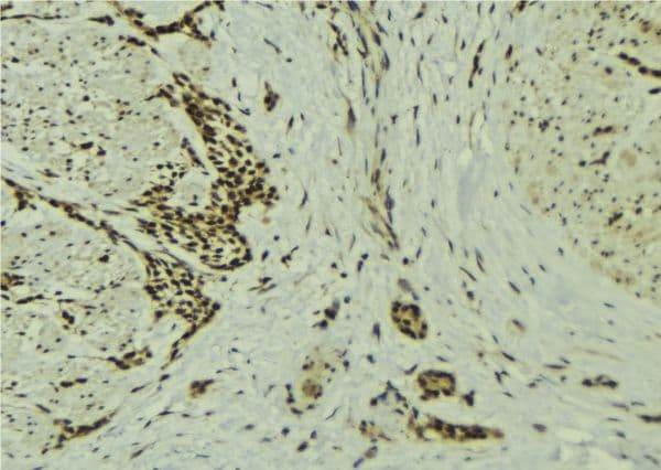 Polyclonal Rabbit anti-Human DXO / DOM3Z Antibody (IHC, WB)