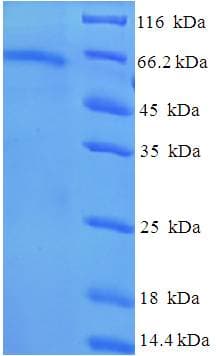 Human TUBB6 / Tubulin Beta 6 Protein (Recombinant His-SUMO)