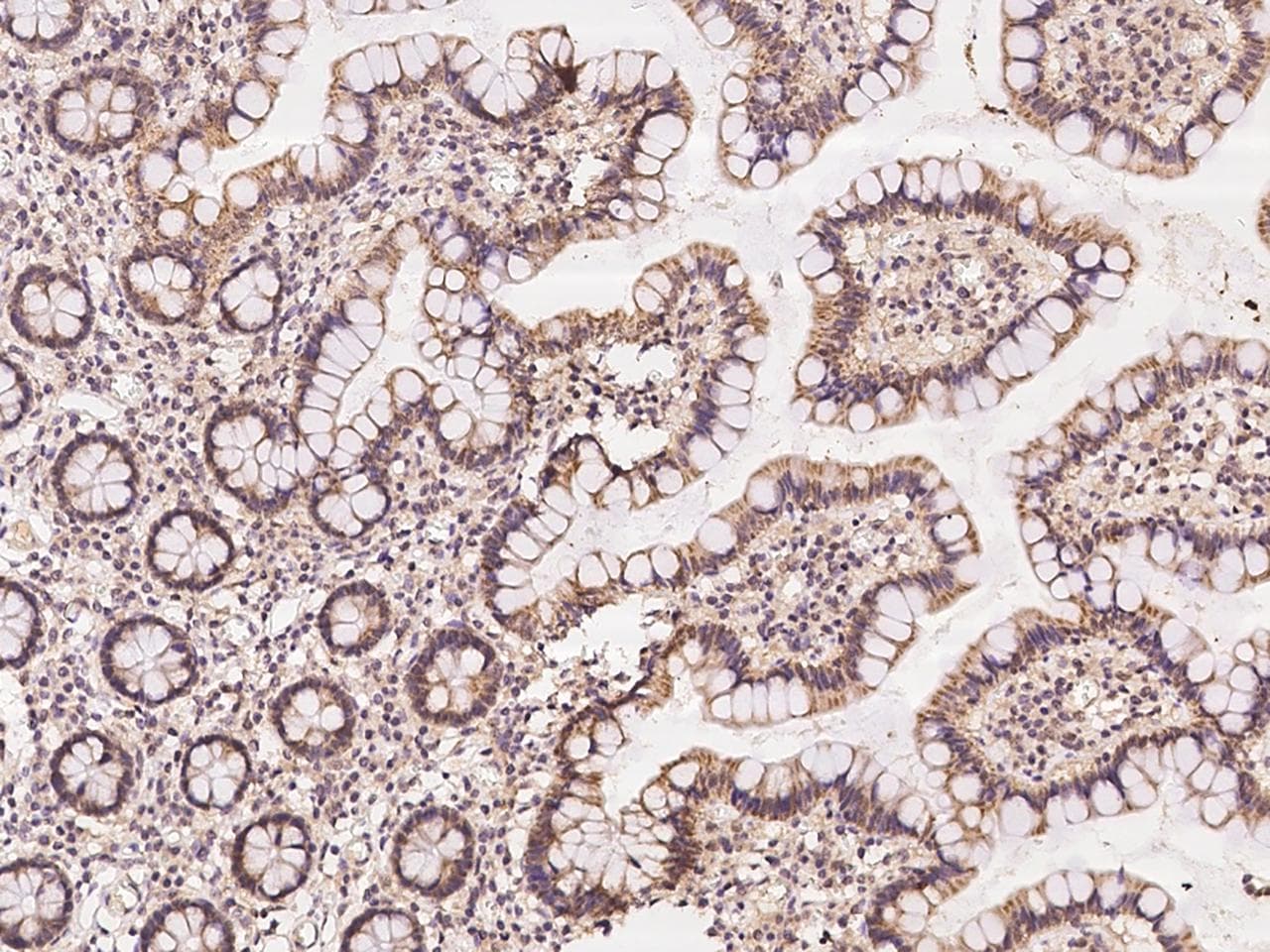 Polyclonal Rabbit anti-Human KIF25 Antibody (IHC)