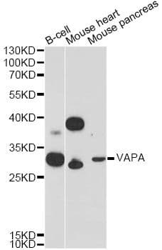 VAP33 / VAPA Antibody